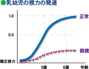 乳幼児の視力の発達