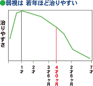 弱視は若年ほど治りやすい